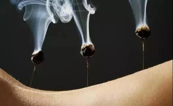 艾灸不是藥，調的不是病，央視為艾灸正名，讓我們正視艾灸