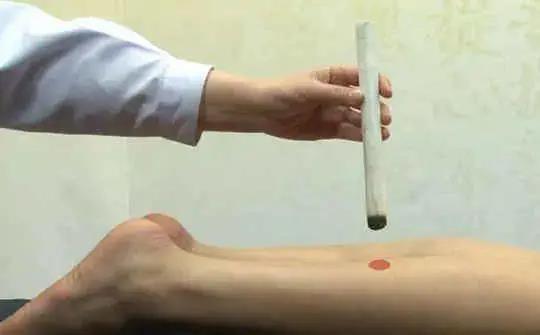 人體“消毒穴”每周艾灸4次，逼出陳年藥毒！