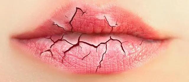 嘴唇干裂，或許不是缺水，嘴唇老是干艾灸什么穴位！