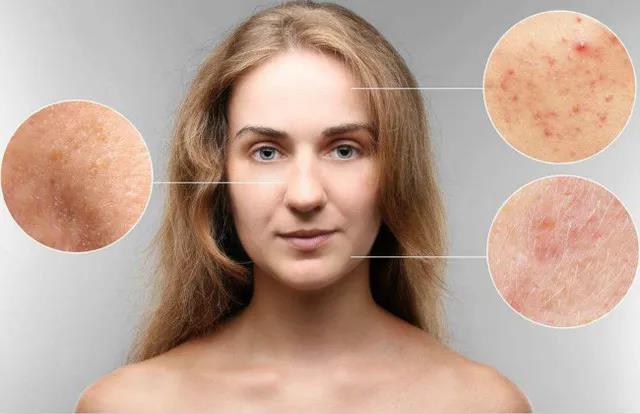 艾灸有美容效果嗎？艾灸哪里能美容