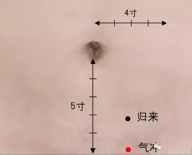 　一艾灸就上火，這是為什么?