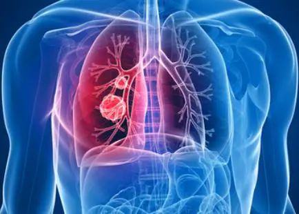 脾胃是健康的根，脾胃和口眼耳鼻、以及五臟的關(guān)聯(lián)全在這！