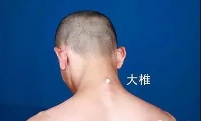 春天灸灸背，能活一百歲~