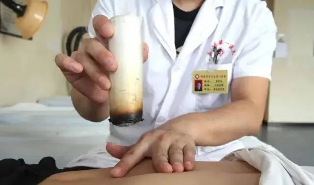 產(chǎn)后艾灸一個(gè)月，十年少生??！ 