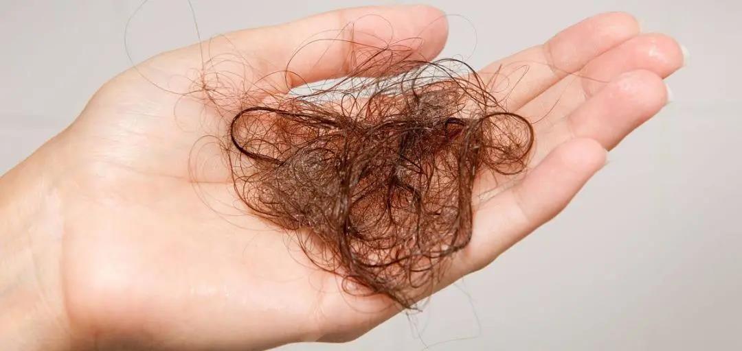 你脫的不是發(fā)，是氣血！艾灸拯救脫發(fā)危機！